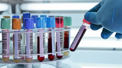 Inteligencia de mercado que trasciende el laboratorio